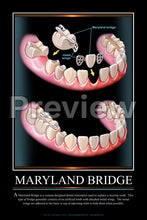 Load image into Gallery viewer, Maryland Bridge Wall Chart