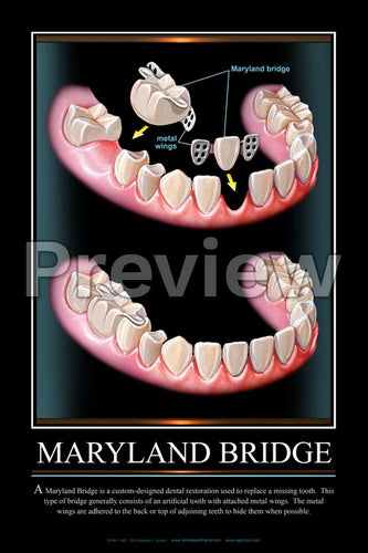 Maryland Bridge Wall Chart