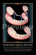 Load image into Gallery viewer, Removable Partial Denture Wall Chart
