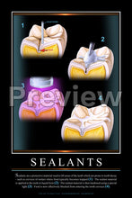 Load image into Gallery viewer, Sealants Wall Chart