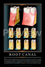 Load image into Gallery viewer, Root Canal Wall Chart